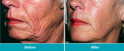 Dr. Jeanine Downie Montclair - Before and After 5