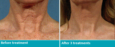 Dr. Jeanine Downie Montclair - Before and After 4