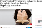 From Topical Treatments to Lasers, Your Complete Guide to Treating Hyperpigmentation