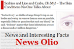 Skin Care Tips Montclair - Newsolio.com