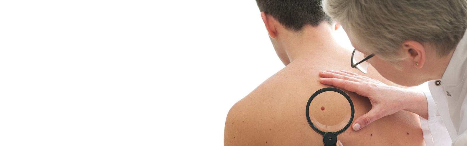 Dermatologist examines a mole