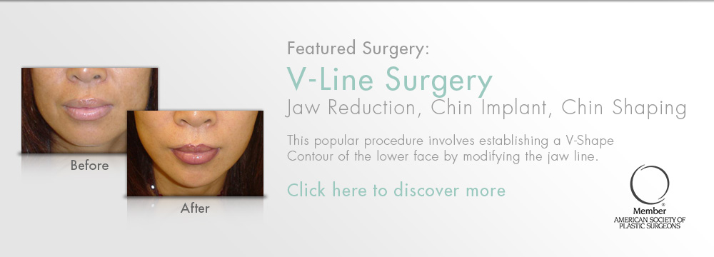 NYC Plastic Surgeon - V-Line Surgery
