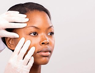 Acne treatments Medical and surgical