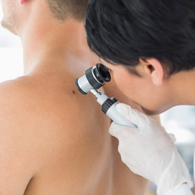 Doctor examining mole on back of man
