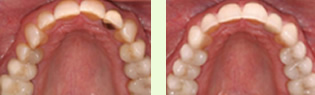 <?php echo $pk;?> - Before After 02