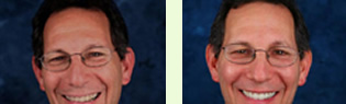 <?php echo $pk;?> - Before After 03