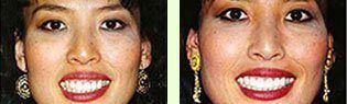 <?php echo $pk;?> - Before After 01