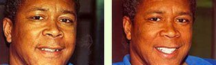 <?php echo $pk;?> - Before After 03