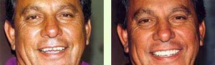 <?php echo $pk;?> - Before After 05