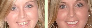 <?php echo $pk;?> - Before After 07