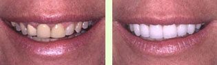 <?php echo $pk;?> - Before After 08