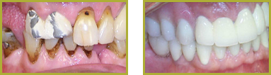 Smile Gallery Wayne - Before After Image 03