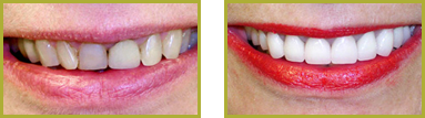 Smile Gallery Wayne - Gallery Image 11