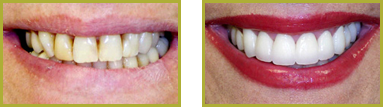 Smile Gallery Wayne - Gallery Image 16