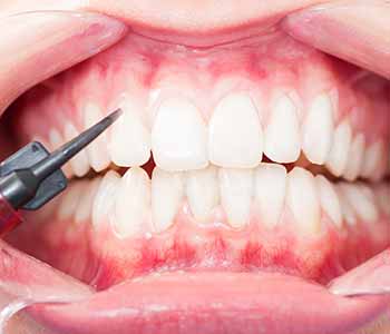 Dr. Christopher T. Griffin, DMD provides reconstruction methods