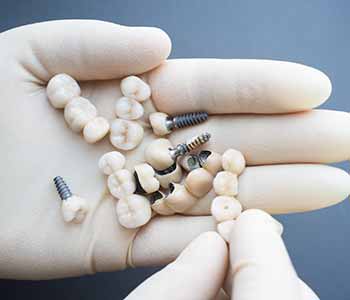 tooth implant surgery in Greenwood, SC