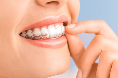 Beautiful smile and white teeth of a young woman