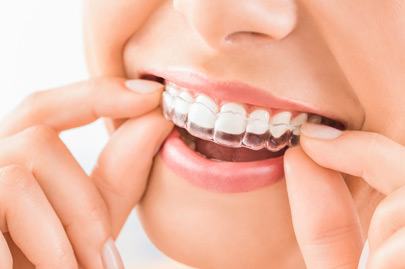 Beautiful smile and white teeth of a young woman