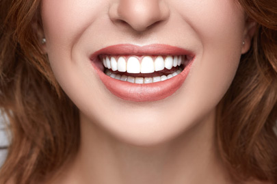 Healthy white smile