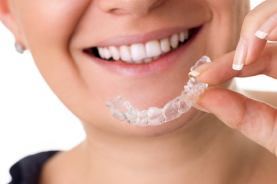 Woman with perfect teeth holding invisible braces