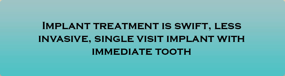 Dentist Fremont - Implant Tx Is Swift, Less Invasive, Single Vistit Immediate Implant And Tooth
