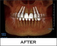 Smile Gallery Fremont - Alaee CT After