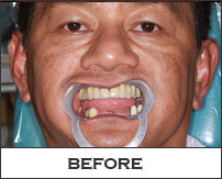 Smile Gallery Fremont - Camelo Before