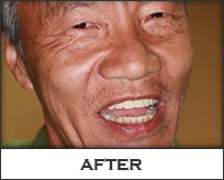 Smile Gallery Fremont - Henry After