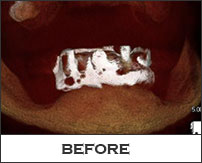 Smile Gallery Fremont - Linda CT Before