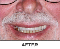 Smile Gallery Fremont - Lowell After