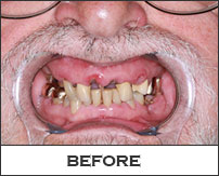 Smile Gallery Fremont - Lowell Before