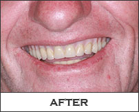 Smile Gallery Fremont - Robert After