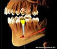 Dentist Fremont - We Plan
