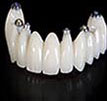Dentist Fremont - We Restore
