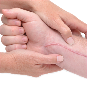 Scar Revision Akron OH - Mayfield Heights - Mentor Photo