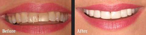 <?php echo $pk;?> - Before After 01