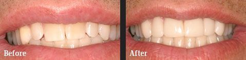 <?php echo $pk;?> - Before After 02