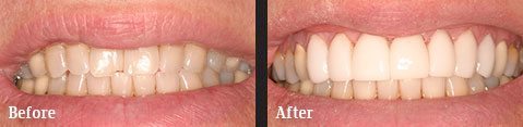 <?php echo $pk;?> - Before After 04