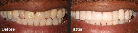 <?php echo $pk;?> - Before After 06