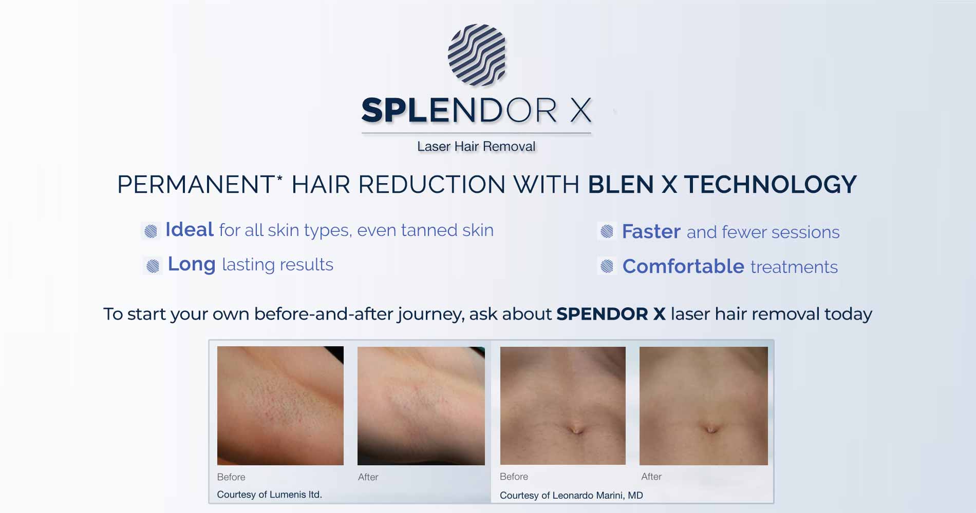 LaseMD Skin Rejuvenation By Khrom