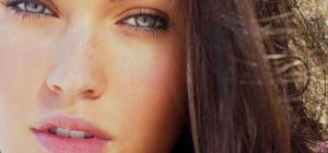 Radiesse Fillers