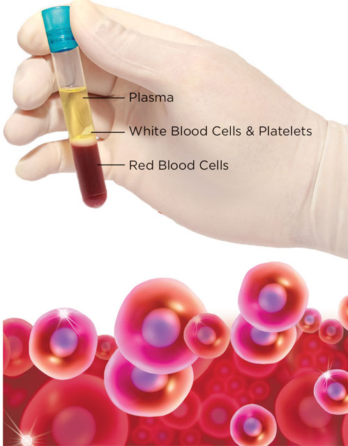 How PRP work