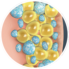 Frozen Fat Cells Frozen Fat Cells
