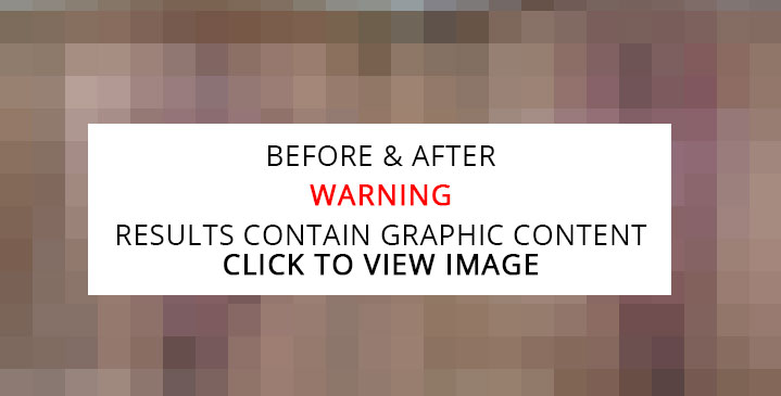 Thermi Graphic Content