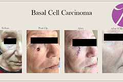 Surgical Before and After 1