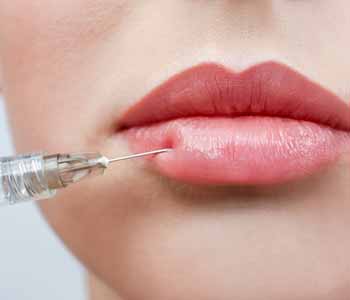 Image of a Lady use Restylane for lip augmentation