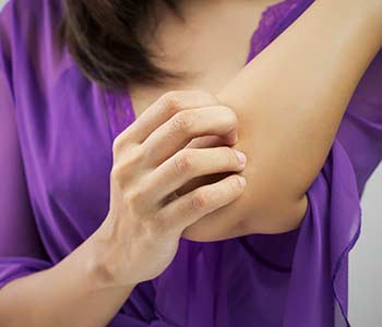 Young woman scratching arm from having itching.