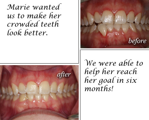 Before After 05