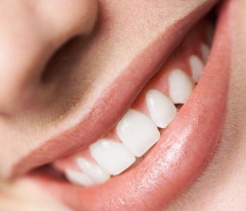 Is teeth whitening always the best option for discolored Phoenix, AZ smiles?