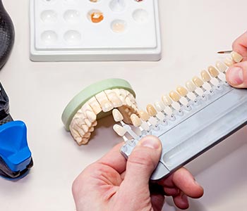Dentist in Phoenix where patients can get the best veneers from a quality team